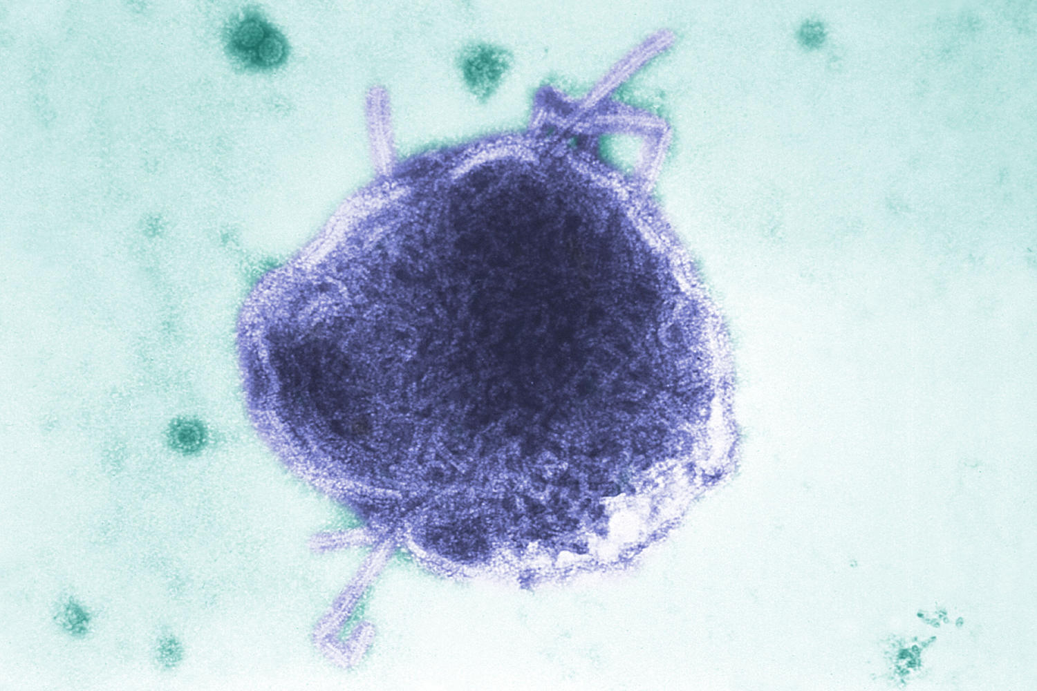 CDC and Pennsylvania Clash Over Measles Deaths Amid Record U.S. Outbreak
