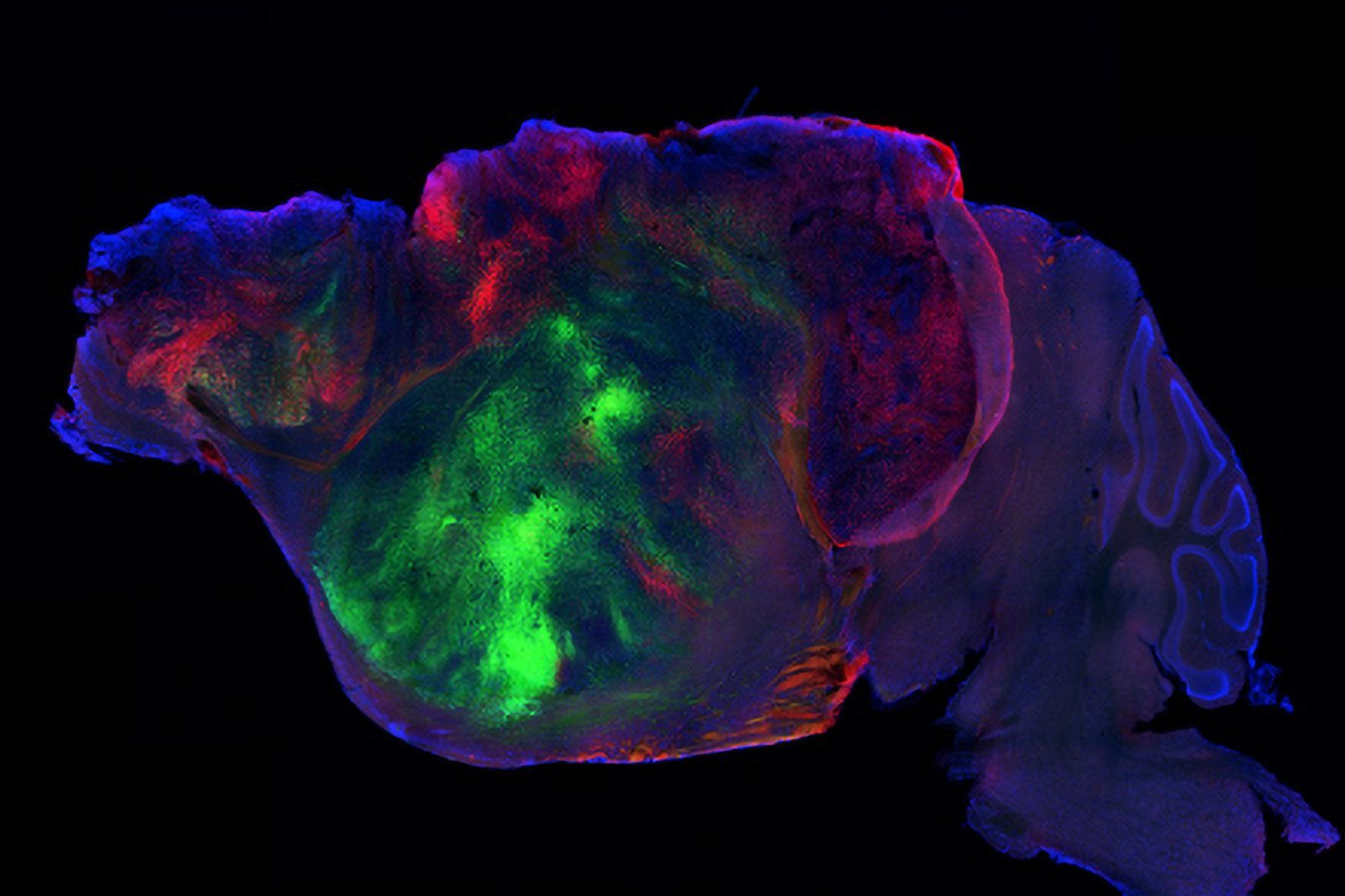 Scientists Replace Mouse Brain Cortex With Human Neurons in Landmark Study
